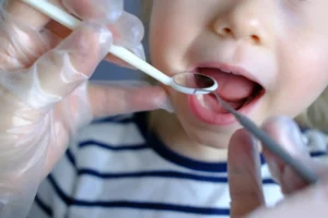 Tongue and Lip Ties: How Precision Lasers Help Your Baby Thrive